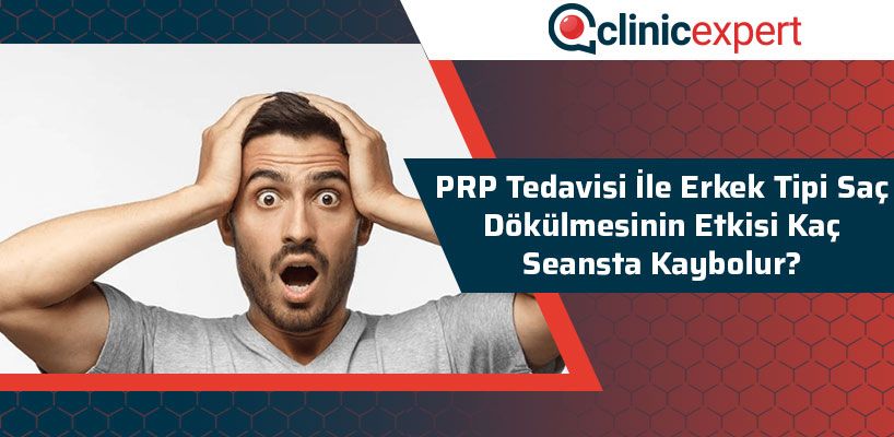 PRP Tedavisi İle Erkek Tipi Saç Dökülmesinin Etkisi Kaç Seansta Kaybolur?