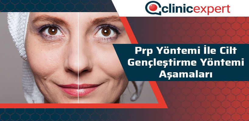 Prp Yöntemi İle Cilt Gençleştirme Yöntemi Aşamaları