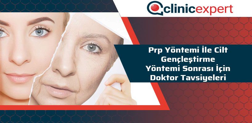 prp-yontemi-ile-cilt-genclestirme-yontemi-sonrasi-icin-doktor-tavsiyeleri-cln