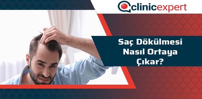 Saç Dökülmesi Nasıl Ortaya Çıkar