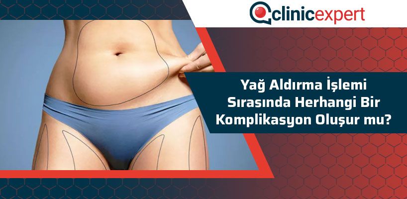 Yağ Aldırma İşlemi Sırasında Herhangi Bir Komplikasyon Oluşur Mu?