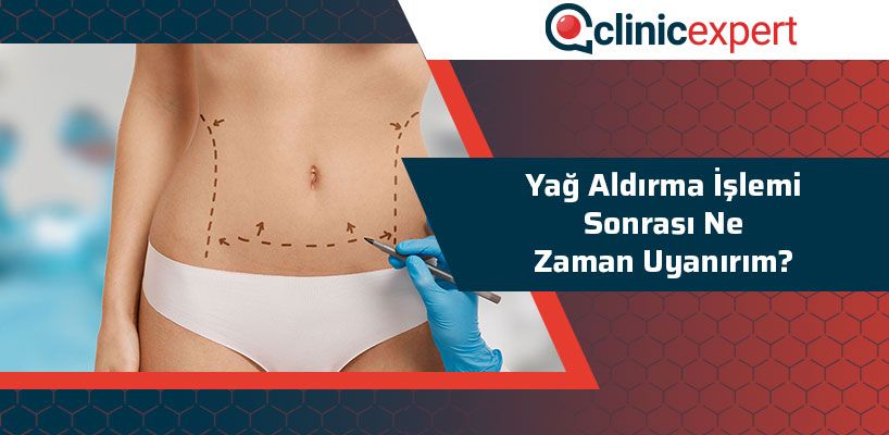 Yağ Aldırma İşlemi Sonrası Ne Zaman Uyanırım?