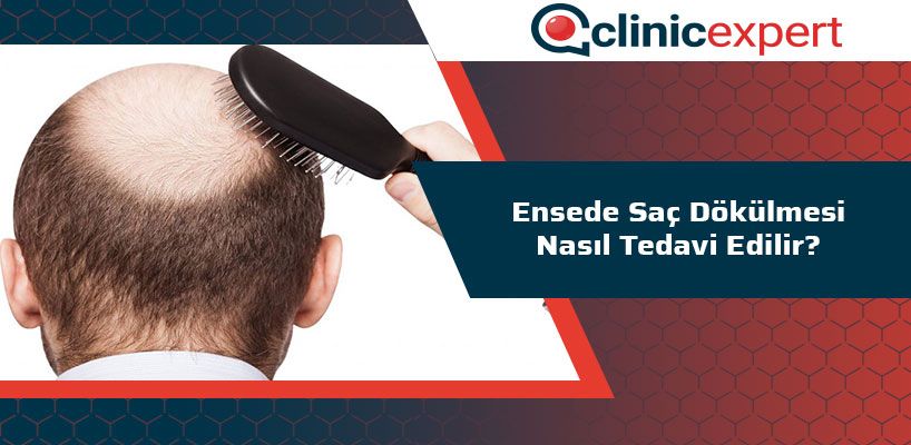 Ensede Saç Dökülmesi Nasıl Tedavi Edilir?