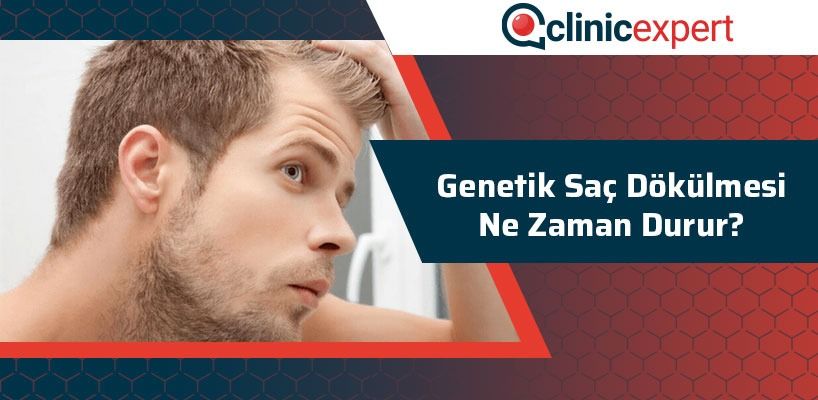 genetik-sac-dokulmesi-ne-zaman-durur-cln