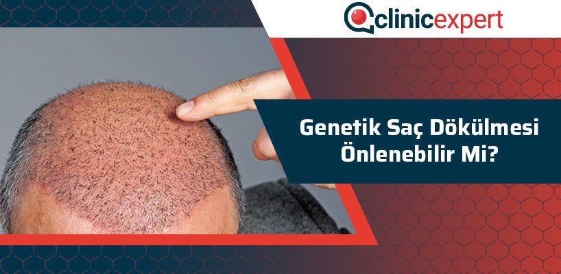 genetik-sac-dokulmesi-onlenebilir-mi-cln