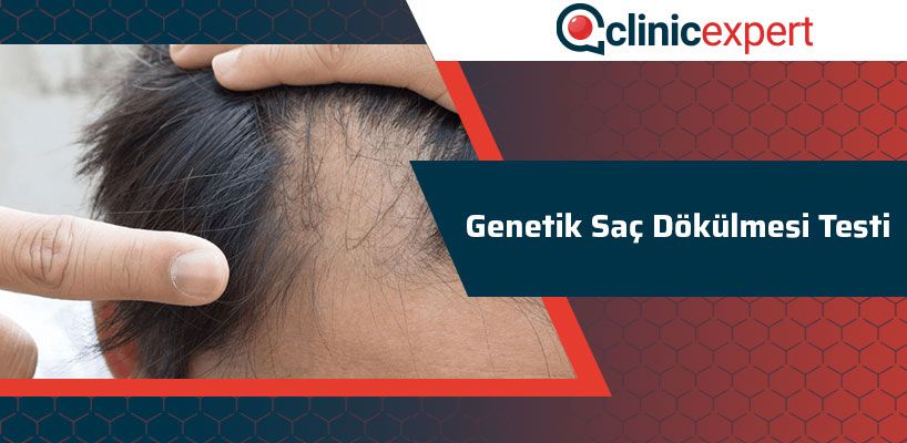 genetik-sac-dokulmesi-testi-cln