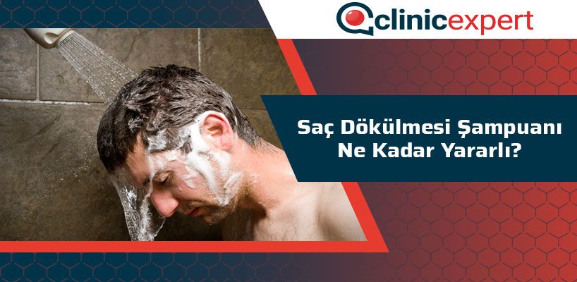 Saç Dökülmesi Şampuanı Ne Kadar Yararlı