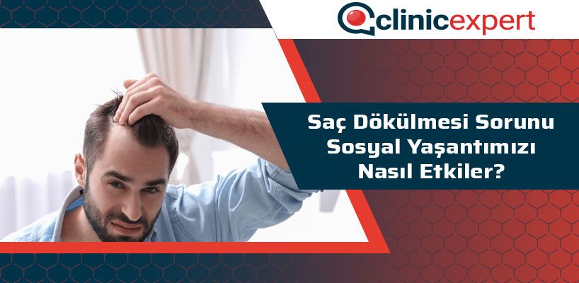 Saç Dökülmesi Sorunu Sosyal Yaşantımızı Nasıl Etkiler?