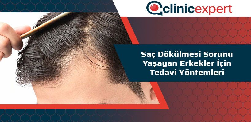 Saç Dökülmesi Sorunu Yaşayan Erkekler İçin Tedavi Yöntemleri