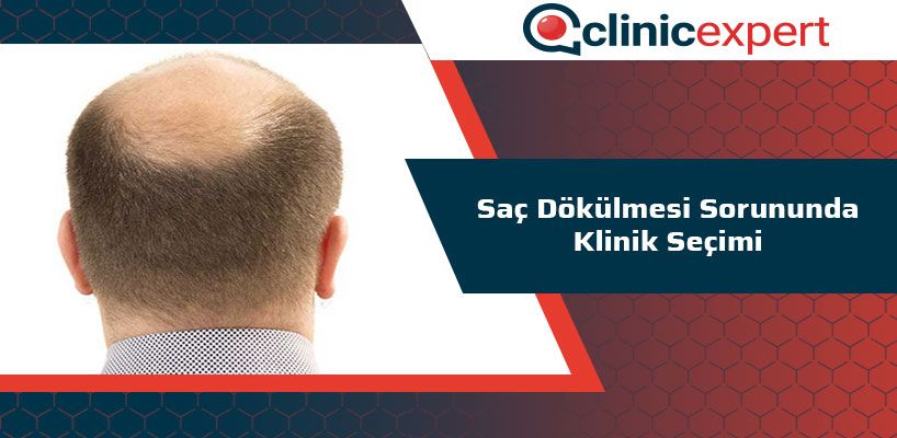 Saç Dökülmesi Sorununda Klinik Seçimi 