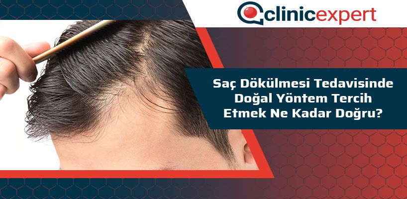 sac-dokulmesi-tedavisinde-dogal-yontem-tercih-etmek-ne-kadar-dogru-cln