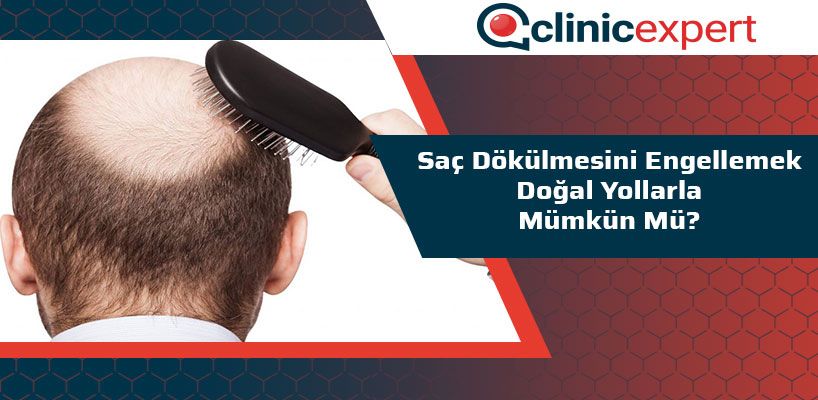 Saç Dökülmesini Engellemek Doğal Yollarla Mümkün Mü