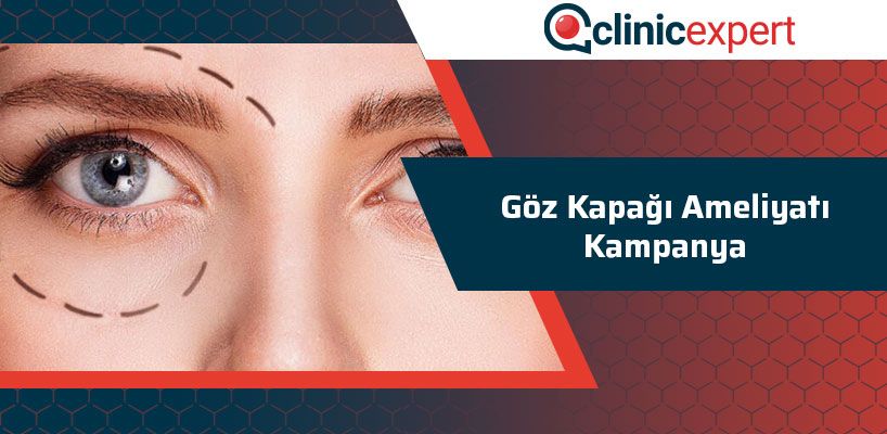 Göz Kapağı Ameliyatı Kampanya