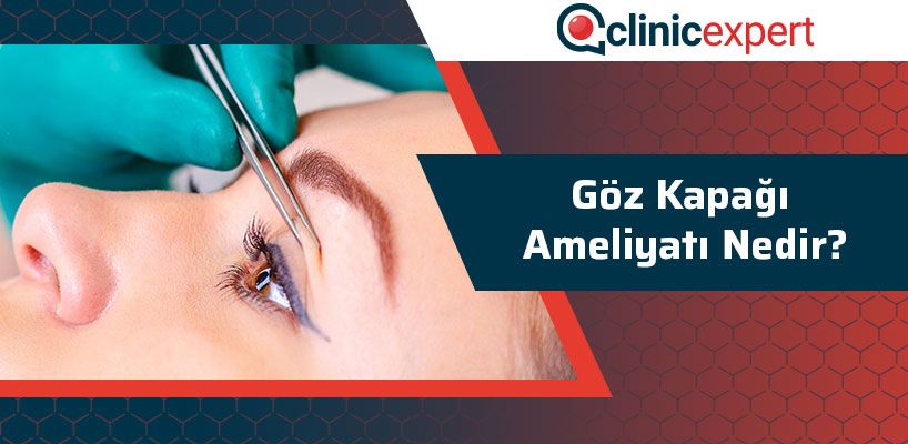 Göz Kapağı Ameliyatı Nedir