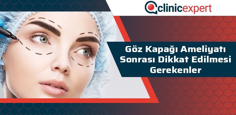 Göz Kapağı Ameliyatı Sonrası Dikkat Edilmesi Gerekenler