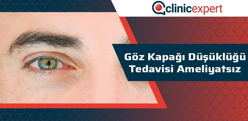 Göz Kapağı Düşüklüğü Tedavisi Ameliyatsız