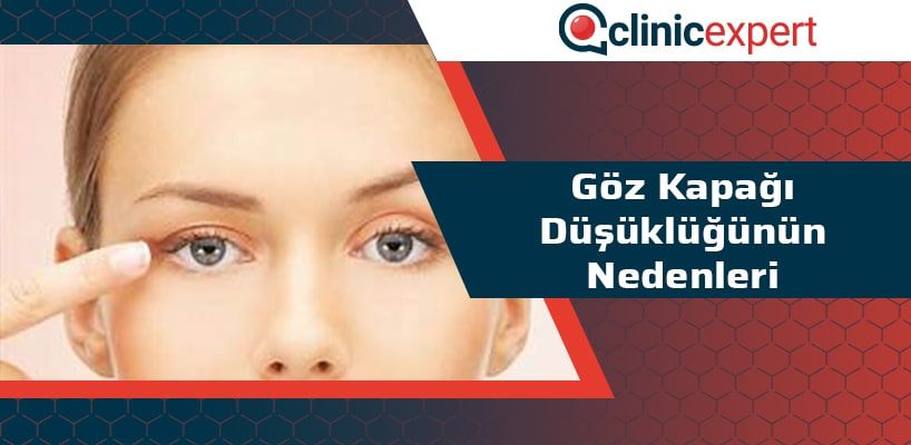 Göz Kapağı Düşüklüğünün Nedenleri