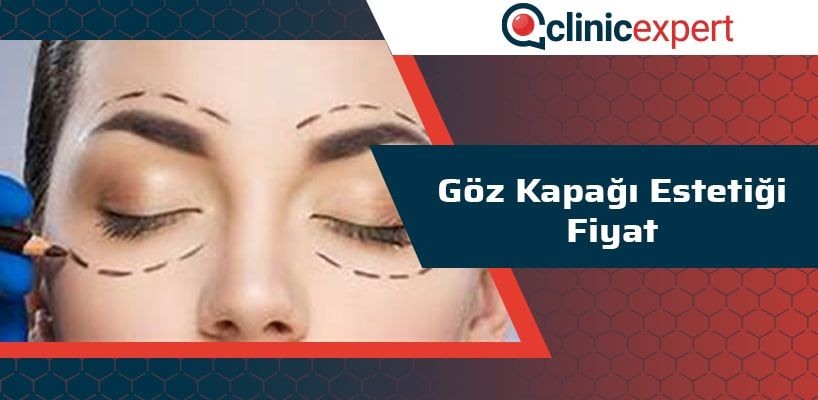 Göz Kapağı Estetiği Fiyat