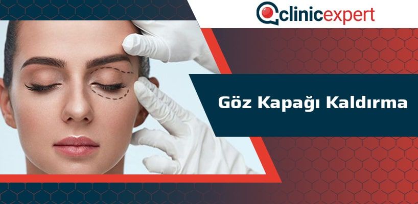 Göz Kapağı Kaldırma