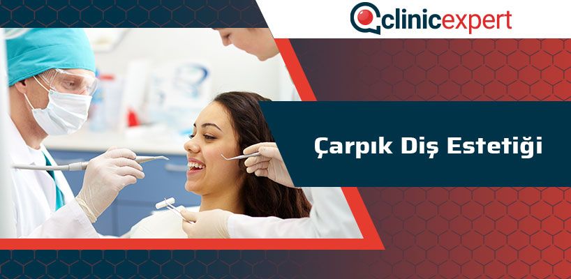 Çarpık Diş Estetiği Nedir