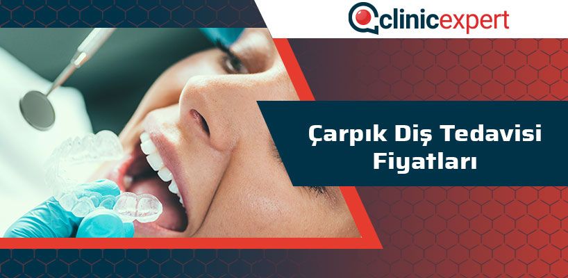 Çarpık Diş Tedavisi Fiyatları