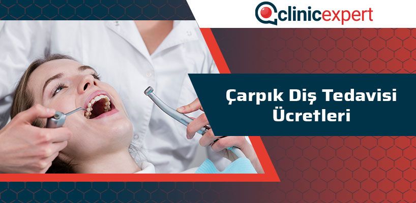 Çarpık Diş Tedavisi Ücretleri