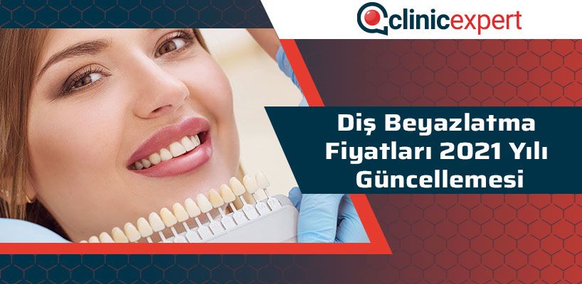 Diş Beyazlatma Fiyatları 2021 Yılı Güncellemesi