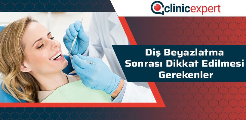 Diş Beyazlatma Sonrası Dikkat Edilmesi Gerekenler