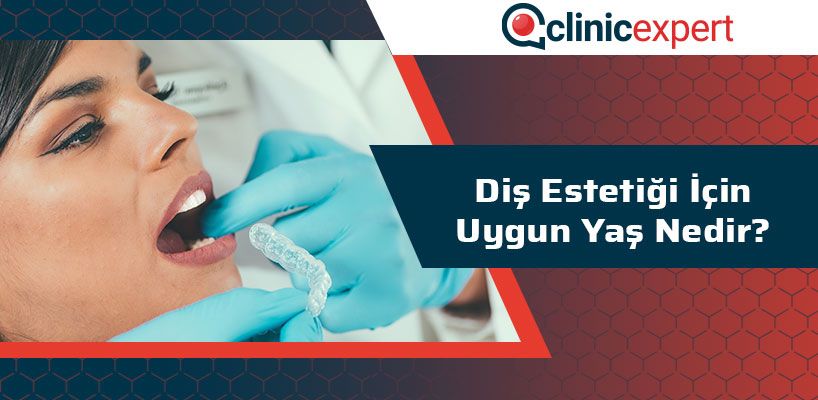 Diş Estetiği İçin Uygun Yaş Nedir?