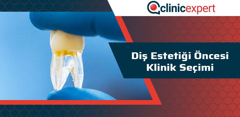 Diş Estetiği Öncesi Klinik Seçimi