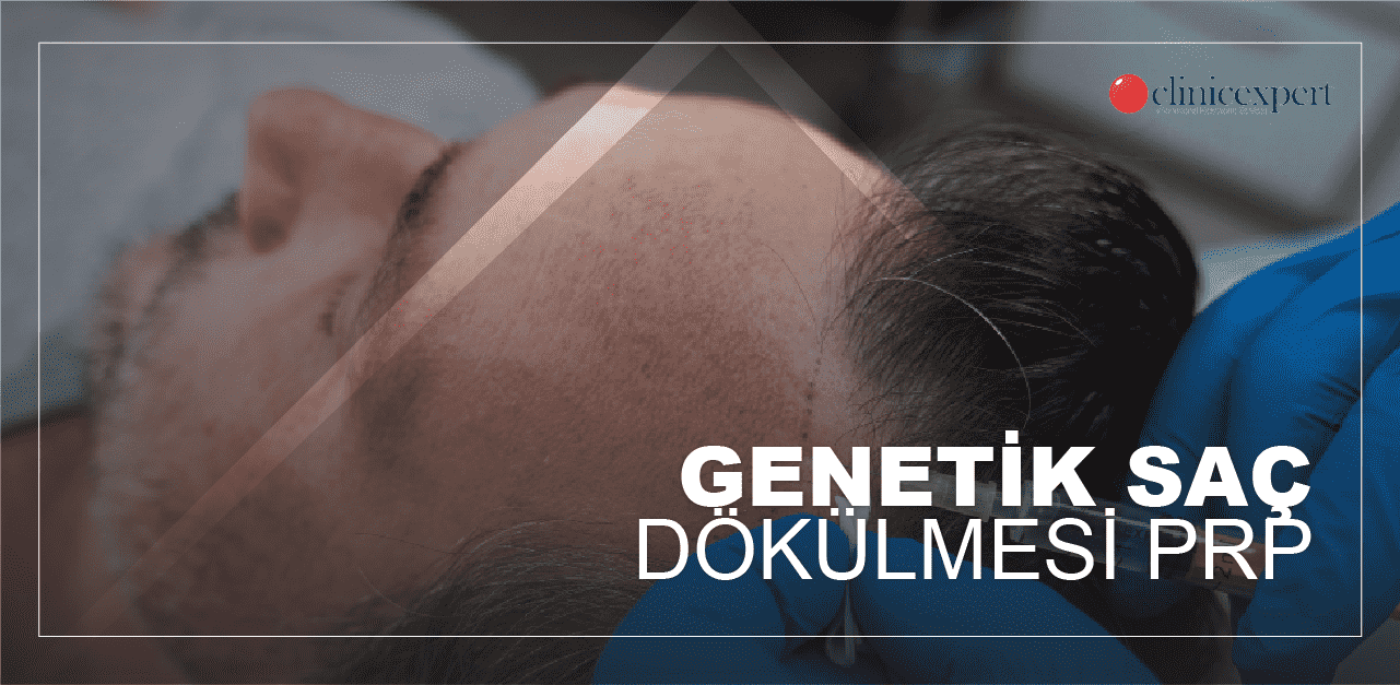 genetik-sac-dokulmesi-min