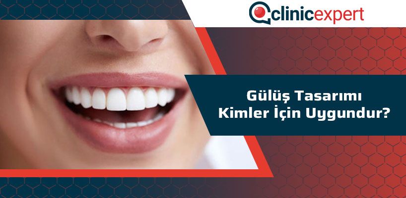 Gülüş Tasarımı Kimler İçin Uygundur?