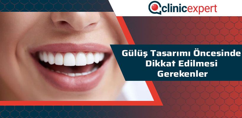 Gülüş Tasarımı Öncesinde Dikkat Edilmesi Gerekenler