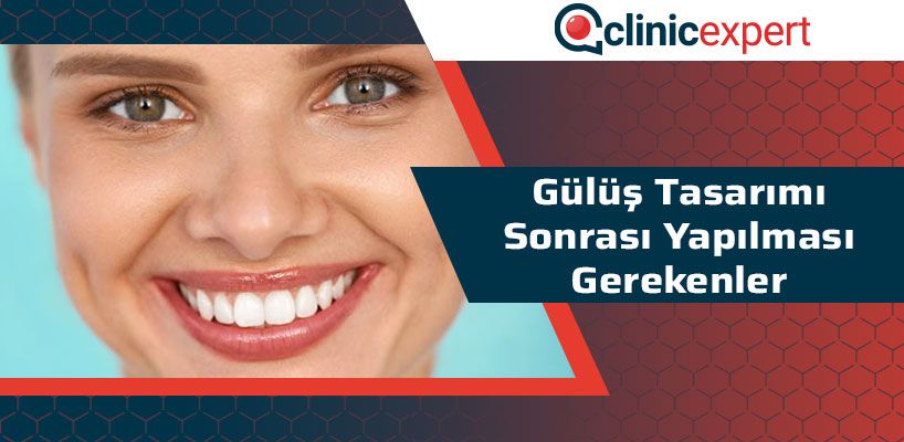 Gülüş Tasarımı Sonrası Yapılması Gerekenler