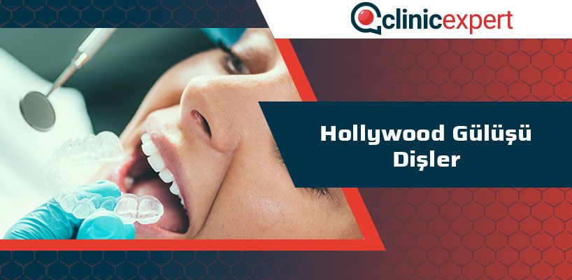 Hollywood Gülüşü Dişler