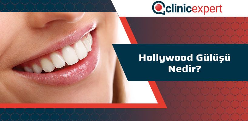 Hollywood Gülüşü Nedir?