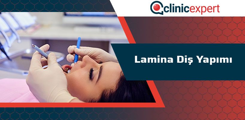 Lamina Diş Yapımı