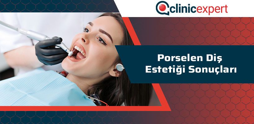 Porselen Diş Estetiği Sonuçları