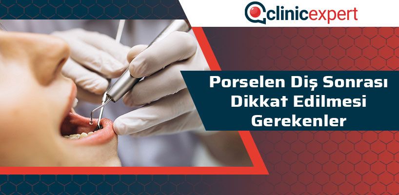 Porselen Diş Sonrası Dikkat Edilmesi Gerekenler 