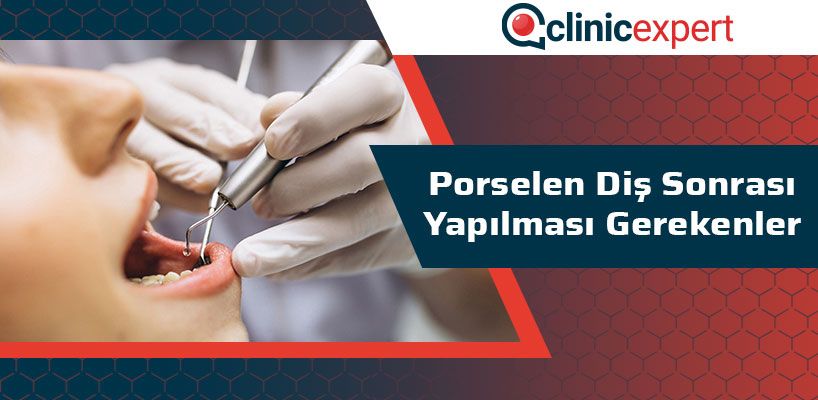 Porselen Diş Sonrası Yapılması Gerekenler