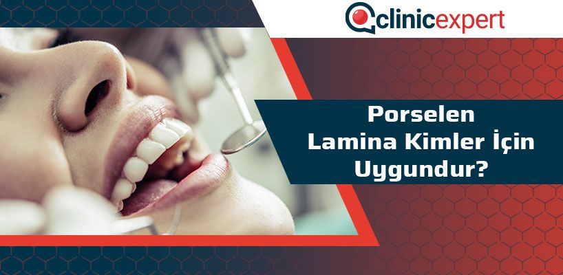 Porselen Lamina Kimler İçin Uygundur?