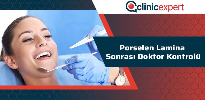 Porselen Lamina Sonrası Doktor Kontrolü