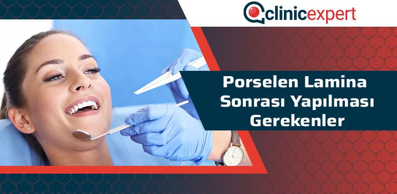 Porselen Lamina Sonrası Dikkat Edilmesi Gerekenler