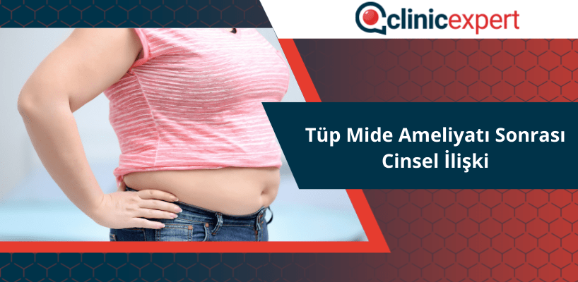 Tüp Mide Ameliyatı Sonrası Cinsel İlişki