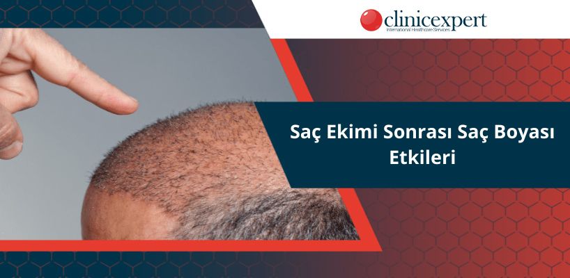 Saç Ekimi Sonrası Saç Boyası Etkileri