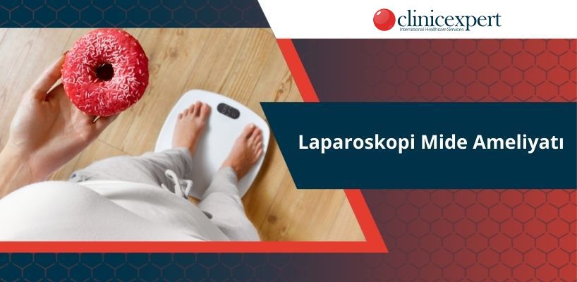 Laparoskopi Mide Ameliyatı