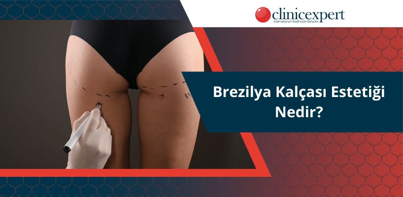 Brezilya Kalçası Estetiği Nedir?