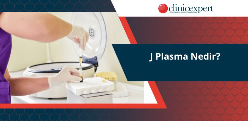 J Plasma Nedir?