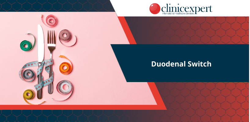 Duodenal Switch