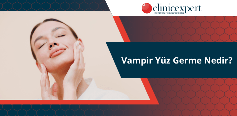 Vampir Yüz Germe Nedir?